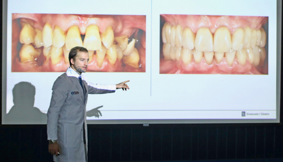 Denti piccoli faccette dentali - Emanuele Cicero dentista a Roma